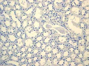 ab110640 showing negative staining in Normal kidney tissue.