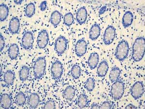 ab110640 showing negative staining in Normal colon tissue.