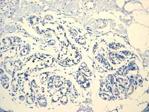 ab110640 showing negative staining in Normal breast tissue.
