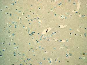 ab110640 showing negative staining in Normal brain tissue.