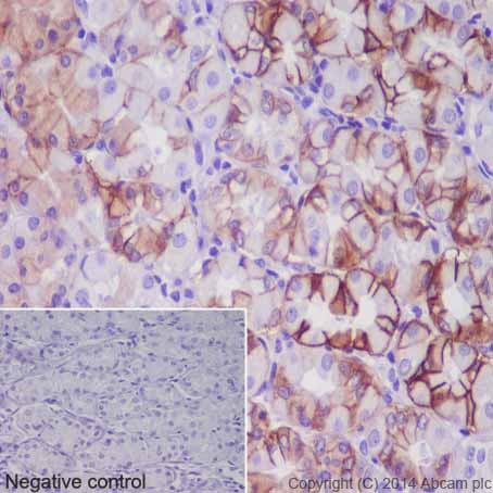 Immunohistochemical analysis of paraffin-embedded Human stomach tissue labeling CA12 with ab195233 at 1/100 dilution followed by Goat Anti-Rabbit IgG H&L (HRP) (ab97051) at 1/500 dilution and counter-stained with Hematoxylin. (inset: negative control).Note: Cell membrane and cytoplasm staining on human stomach tissue was observed.