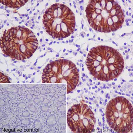 Immunohistochemical analysis of paraffin-embedded Human colon tissue labeling CA12 with ab195233 at 1/100 dilution followed by Goat Anti-Rabbit IgG H&L (HRP) (ab97051) at 1/500 dilution and counter-stained with Hematoxylin. (inset: negative control).Note: Cell membrane and cytoplasm staining on human colon tissue was observed.