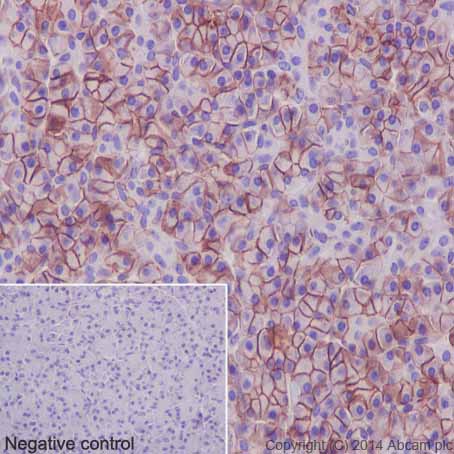 Immunohistochemical analysis of paraffin-embedded Human pancreas tissue labeling CA12 with ab195233 at 1/100 dilution followed by Goat Anti-Rabbit IgG H&L (HRP) (ab97051) at 1/500 dilution and counter-stained with Hematoxylin. (inset: negative control).Note: Cell membrane and weakly cytoplasm staining on human pancreas tissue was observed.