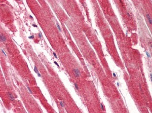 Human Heart (formalin-fixed, paraffin-embedded) stained with ab118877 at 5 ug/ml followed by biotinylated anti-mouse IgG secondary antibody, alkaline phosphatase-streptavidin and chromogen.