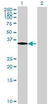 All lanes : Anti-CA6 antibody (ab72922) at 1/500 dilutionLane 1 : CA6 transfected 293T lysate Lane 2 : Non-transfected 293T lysateLysates/proteins at 25 µg per lane.SecondaryGoat Anti-Mouse IgG (H&L)-HRP Conjugate at 1/2500 dilutionObserved band size : 34 kDa (why is the actual band size different from the predicted?)
