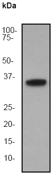 Anti-CAB39 antibody [EP1680Y] (ab51132) at 1/20000 dilution + HeLa cell lysate at 10 µgSecondaryGoat anti-rabbit HRP labeled at 1/2000 dilution