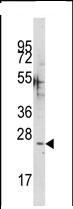 Anti-CABP antibody - Carboxyterminal end (ab75949) at 1/60 dilution + mouse cerebellum tissue lysate at 35 µg