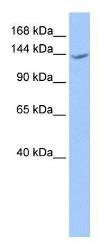 Anti-CACHD1 antibody (ab75141) at 1 µg/ml + fetal brain lysate at 10 µgSecondaryHRP-conjugated anti-Rabbit IgG at 1/50000 dilution