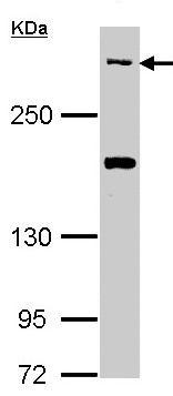 Anti-CACNA1B (N type) antibody (ab97284) at 1/1000 dilution + A549 whole cell lysate at 30 µg