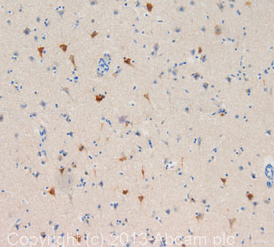 IHC image of CACNA1C staining in human cerebral cortex formalin fixed paraffin embedded tissue section, performed on a Leica Bond system using the standard protocol F. The section was pre-treated using heat mediated antigen retrieval with sodium citrate buffer (pH6, epitope retrieval solution 1) for 20 mins. The section was then incubated with ab81095, 1µg/ml, for 15 mins at room temperature and detected using an HRP conjugated compact polymer system. DAB was used as the chromogen. The section was then counterstained with haematoxylin and mounted with DPX.For other IHC staining systems (automated and non-automated) customers should optimize variable parameters such as antigen retrieval conditions, primary antibody concentration and antibody incubation times.