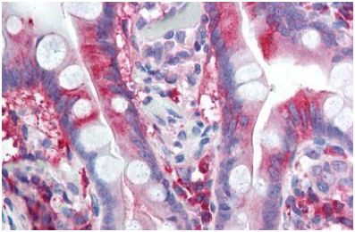 Immunohistochemical analysis of formalin-fixed, paraffin-embedded Human small intestine tissue labelling CACNA1C with ab140760 at 2.5 µg/ml.