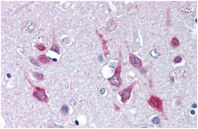 Immunohistochemical analysis of formalin-fixed, paraffin-embedded Human brain cortex tissue labelling CACNA1C with ab140766 at 5 µg/ml.