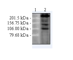 All lanes : Anti-CACNA1C antibody [S57-46] (ab84814) at 1 µg/mlLane 1 : Molecular weight markerLane 2 : Cell lysates prepared from DHPR alpha 1 transfected CHO cells