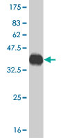 Anti-CACNA1F antibody (ab54918) at 5 µg/ml + 0.2 µg/lane of partial recombinant protein with a tagSecondaryGoat anti mouse IgG (H&L)-HRP conjugate at 1/5000 dilution