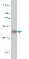 Western blot against tagged recombinant protein immunogen using ab56439 CACNA1I antibody at 1ug/ml.