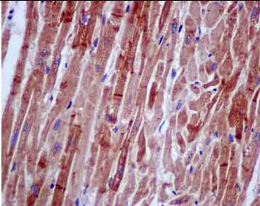 Immunohistochemical analysis of paraffin-embedded Human cardiac muscle tissue labeling CACNA2D2 with ab181201 at 1/100 dilution. The slide is counterstained with Hematoxylin.