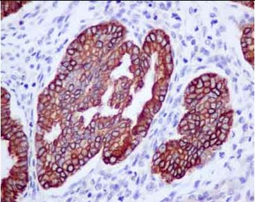 Immunohistochemical analysis of paraffin-embedded Human endometrium tissue labeling CACNA2D2 with ab181201 at 1/100 dilution. The slide is counterstained with Hematoxylin.