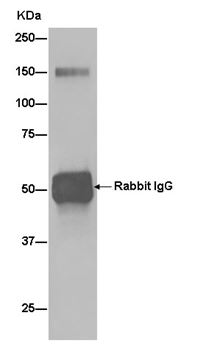 Immunoprecipitation of Human fetal brain lysates using ab181201. Detection of CACNA2D2 utilised ab181201 at 1/50 dilution and Goat Anti-Rabbit IgG, (H+L), Peroxidase conjugated at 1/1000 dilution.