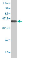 Western blot against tagged recombinant protein immunogen using ab54919 CACNB1 antibody at 1ug/ml.