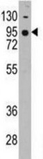 Anti-Cadherin 7 antibody - N-terminal (ab189965) at 1/60 dilution + K562 cell lysate