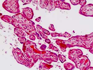 Immunohistochemical analysis of formalin-fixed, paraffin-embedded Human placenta tissue labeling Cadherin 9 with ab178500 at 5 µg/ml.