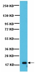 Anti-Calcineurin B antibody (ab136526) at 1/500 dilution + A431 lysate Secondarydonkey anti-rabbit secondary antibody conjugated to HRP developed using the ECL technique