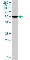 Anti-Calcitonin receptor antibody (ab103422) at 5 µg/ml + Human kidney tissue lysate at 50 µg