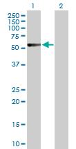 All lanes : Anti-Calcitonin receptor antibody (ab103422) at 5 µg/mlLane 1 : Calcitonin receptor transfected 293T cell lysateLane 2 : Non-transfected 293T cell lysateLysates/proteins at 25 µg per lane.