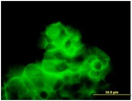 Immunofluorescent analysis of Calcitonin receptor expression in 293 cells using ab167330 at 2 µg/ml dilution