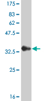 Western blot against tagged recombinant protein immunogen using ab56953 Calcium binding protein P22 antibody at 1ug/ml.