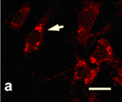 Immunofluorescence analysis of mouse superior cervical ganglion cells, staining Calcium channel L type DHPR alpha 2 subunit with ab80990. Cells were fixed with paraformaldehye, permeablized 0.5% Triton X-100 and blocked with normal chicken serum for 30 min at room temperature. Samples were incubated overnight with primary antibody (1/100 followed by incubation for 1 hour with an AlexaFluor®-conjugated anti-rabbit secondary antibody (1/500).