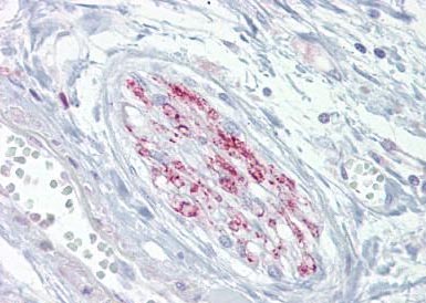 Immunohistochemical analysis of formalin-fixed, paraffin embedded Human nerve tissue labelling Calcium channel L type DHPR alpha 2 subunit with ab133381 at 10µg/ml. Followed by biotinylated goat anti-rabbit IgG secondary antibody, alkaline phosphatase-streptavidin and chromogen.