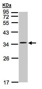 Anti-Calcium channel L type DHPR gamma 5 subunit antibody (ab96713) at 1/1000 dilution + HepG2 whole cell lysate at 30 µg