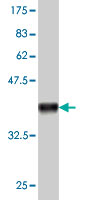Western blot against tagged recombinant protein immunogen using ab57236 ACOT11 antibody at 1ug/ml.