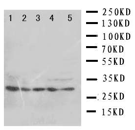 All lanes : Anti-14-3-3 sigma antibody (ab190960) at 0.5 µg/mlLane 1 : HeLa cell lysateLane 2 : A549 cell lysateLane 3 : A549 cell lysateLane 4 : COLO320 cell lysateLane 5 : SE620 cell lysate