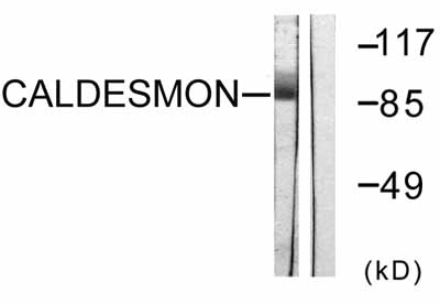 All lanes : Anti-Caldesmon antibody (ab58502) at 1/500 dilutionLane 1 : HeLa cell extract treated with EGF (200ng/ml, 30mins)Lane 2 : HeLa cell extract treated with EGF (200ng/ml, 30mins) with immunising peptide