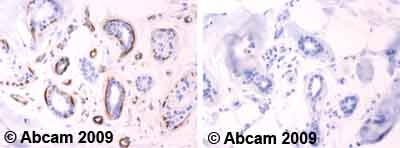 Ab58502 staining Human normal skin. Staining is localised to the cytoplasm.Left panel: with primary antibody at 2 ug/ml. Right panel: isotype control.Sections were stained using an automated system DAKO Autostainer Plus , at room temperature. Sections were rehydrated and antigen retrieved with the DAKO 3-in-1 antigen retrieval buffer EDTA pH 9.0 in a DAKO PT Link. Slides were peroxidase blocked in 3% H2O2 in methanol for 10 minutes. They were then blocked with Dako Protein block for 10 minutes (containing casein 0.25% in PBS) then incubated with primary antibody for 20 minutes and detected with Dako Envision Flex amplification kit for 30 minutes. Colorimetric detection was completed with diaminobenzidine for 5 minutes. Slides were counterstained with Haematoxylin and coverslipped under DePeX. Please note that for manual staining we recommend to optimize the primary antibody concentration and incubation time (overnight incubation), and amplification may be required.