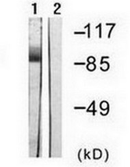 All lanes : Anti-Caldesmon antibody (ab133224) at 1/500 dilutionLane 1 : HeLa cell extracts, treated with EGF (200 ng/ml for 30 minutes)Lane 2 : HeLa cell extracts, treated with EGF (200 ng/ml for 30 minutes) with synthesized peptide