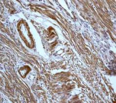 ab32300, at a 1/250 dilution, staining human Caldesmon in uterus tissue by Immunohistochemistry, Paraffin embedded tissue