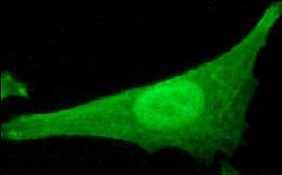 ab32330, at a 1/250 dilution, staining human Caldesmon in HeLa cells by Immunofluorescence