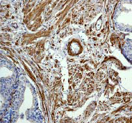 Ab45691 (1:250) staining human Caldesmon in human normal prostate tissue by immunohistochemistry using paraffin embedded tissue.