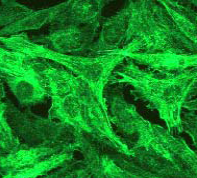 Immunofluorescent staining of HeLa cells using ab45691 (1:250).