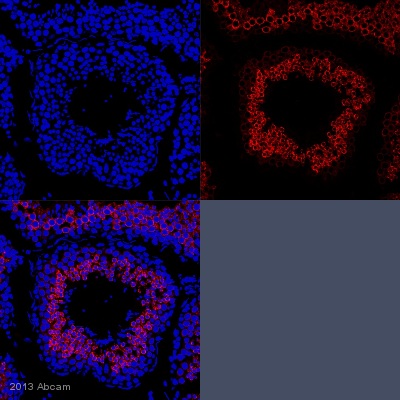 IHC-P image of Calmegin staining with ab171971 on tissue sections from adult marmoset testis. The sections were subjected to heat-mediated antigen retrieval using Dako antigen retrieval solution. The sections were then blocked with 5% milk for 30 minutes at 25°C, before incubation with ab171971 (1/500 dilution) for 18 hours at 4°C. The secondary was an Alexa-Fluor 555 conjugated goat anti-rabbit polyclonal, used at a 1/500 dilution.See Abreview