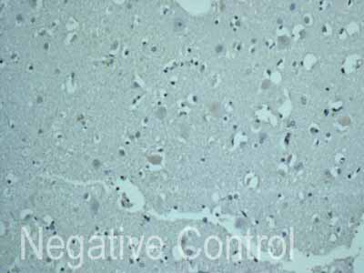 ab171971 showing -ve staining in Human normal brain tissue.