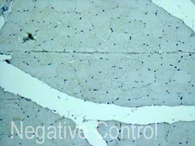 ab171971 showing -ve staining in Human skeletal muscle tissue.