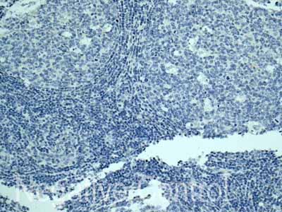 ab171971 showing -ve staining in Human normal tonsil tissue.