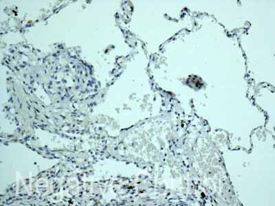 ab171971 showing -ve staining in Human normal lung tissue.