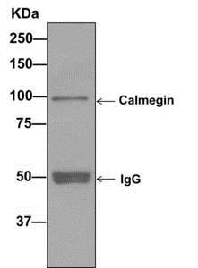 Western blot analysis on immunoprecipitation pellet from Human testis lysate, labeling Calmegin using ab171971 at a 1/10 dilution and an IgG control.