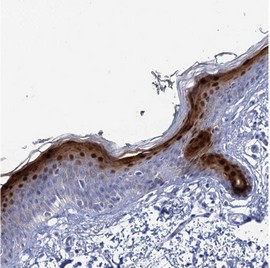 ab122665 at 1/2500 dilution staining CALML5 in paraffin-embedded Human skin tissue by Immunohistochemistry.