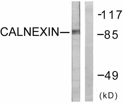 All lanes : Anti-Calnexin antibody (ab58504) at 1/500 dilutionLane 1 : HeLa cells treated with EDF (200ng/ml, 30mins), without immunising peptideLane 2 : HeLa cells treated with EDF (200ng/ml, 30mins), with immunising peptide